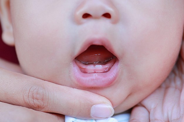Cách xử lý khi bé sốt mọc răng kéo dài hoặc có biểu hiện nghiêm trọng?